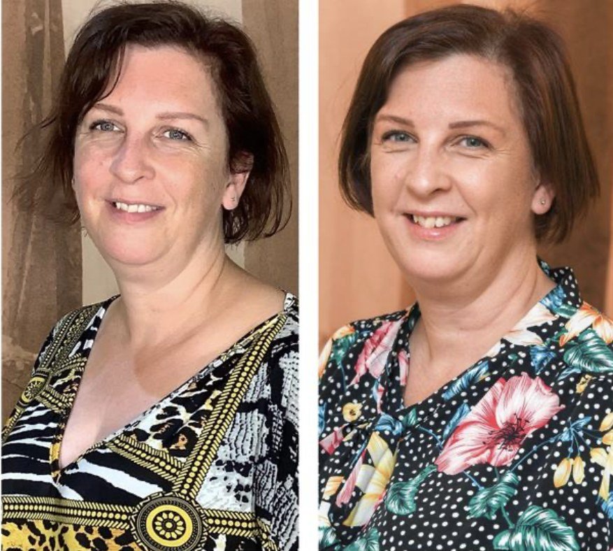 Kerastraight Hair Smoothing